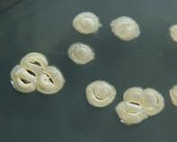 streptomyces colonies streptomyces colonies